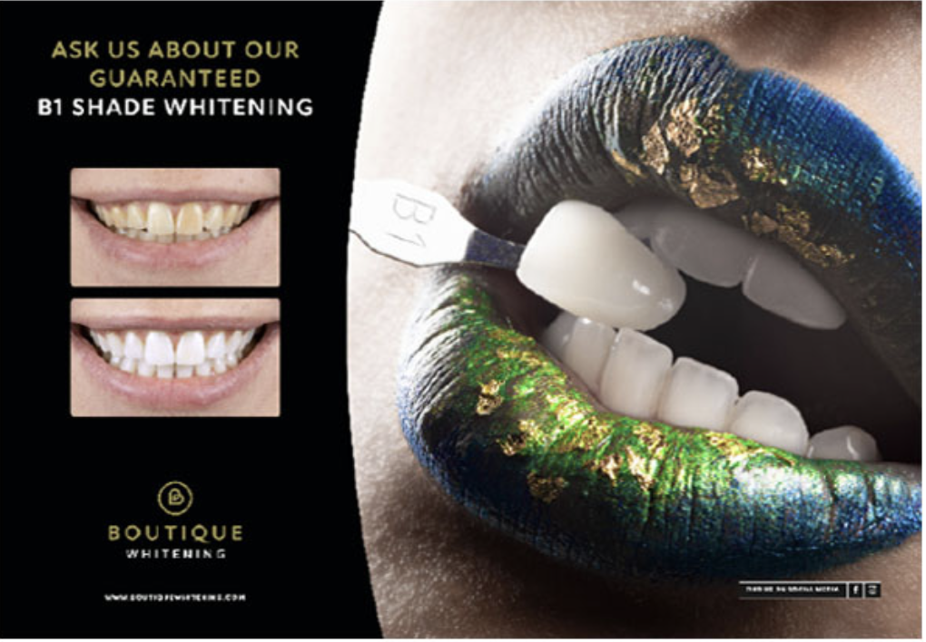 Boutique B1 shade teeth whitening